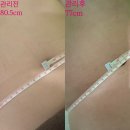 힐링수 사우나 | 부산 뱃살빼기 추천: 서구 에스테틱 힐링수 복부뱃살관리 솔직후기