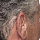 도화보청기 이미지