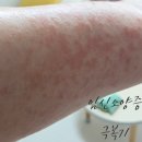 이화제일약국 | 이대서울병원 산부인과 | 임신 중기 소양증 극복기 + 관리 TIP