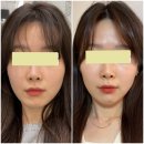 영종도 운서 에스테틱 추천 : 오브에스떼에서 윤곽관리 받은 후기 내돈내산 / 영종도 피부관리샵 추천