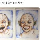 치아교정의 중요성 이미지