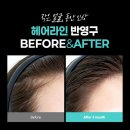헤어라인 이미지