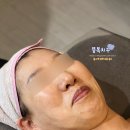보들스킨케어