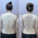 순환체형관리