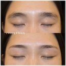 케이디메디컬안성지점 | 안성왁싱 J왁싱&뷰티: 국제 인증 전문가의 피부 건강 중심 메디컬 왁싱 경험한 케어 후기