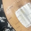 제일한방실업 | 2026/1/29 연세 세브란스병원에서 자궁근종 절제술 복강경 수술 후기 -2편