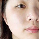 조이메디 이미지