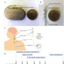 Inflammatory Reflex: 신경-면역 상호작용의 기초 메커니즘. 크론병 사례로 이미지