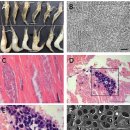 징거미새우의 흰꼬리병의 원인 미포자충 Potaspora macrobranchium 이미지