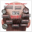 에스-비