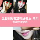 자은아름다운의원 | 가만있어도 미소가 절로 생기는 대구 입꼬리보톡스