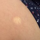 은정약국 | [Diet] 위고비 0.25mg 내돈내산 후기 식단일기