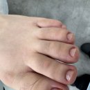레푸스앤두두네일