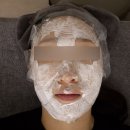 [광주 피부과] 수완지구 할리우드 MLA 프락셀 내 돈 내산 일주일간의 후기