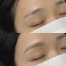 키닛브로우바