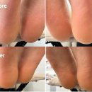 서울중랑초등학교 | [네일을정하다] 중랑구발각질 발뒤꿈치관리 대만족 후기