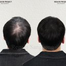 리게인프로젝트 상봉점 이미지