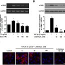 Re: 비타민 D의 fibroblast 과증식에 의한 섬유화 방지 기전(비강폴립) 이미지