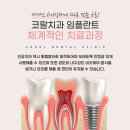 석치과기공소 이미지