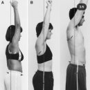 관절 근육 강화 운동 이미지