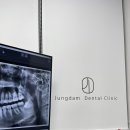 정담치과의원 | 의정부 양심치과 추천: 고산정담치과 성인진료 내돈내산 후기