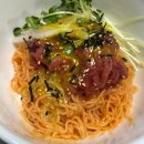 사랑니 발치 후 음식이 반 이상인 일상을 기록하는 건 고통스러워