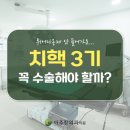 시원항외과의원 | 광교항문외과 치핵 3기, 꼭 수술해야 할까?