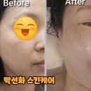 박선화스킨케어