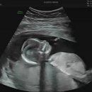 우리맘산부인과의원 이미지