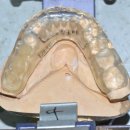 올바른치과기공소 이미지