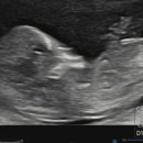 맘존 여성병원 이미지