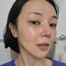 그녀들의 스킨케어 | 스킨부스터 ECM 내돈내산 후기, 리디엔에이 한 종류 앰플 가격으로 시술급 관리 가능?