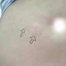 에프엠1차 | [임신 준비 EP8] 시험관 1차 두 번째 진료 : 세트로타이드, 아이브에프엠 에이치피 600