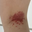 러블리의원 이미지