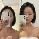 웰메디칼 | 논현역 피부관리 추천 뷰티다룸 강남본점 승모근후기