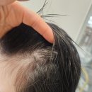 차 앤 박 헤어 | 해운대센텀에서 여성 헤어라인,정수리 탈모로 고민중이시라면~?! 정답은 에코레비헤어앤스파 센텀점입니다🫡