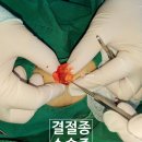 분당서울정형외과 네이버블로그