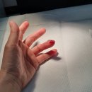 #멸균병원 #손가락꼬매기 잘하는 연세동묘정형외과 통증클리닉
