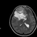 비엔피신경과의원 이미지