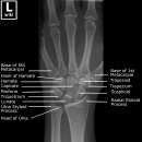 파트라슈 이미지