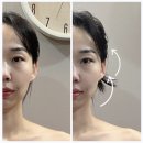 수미원 | 대구 달서구 에스테틱 작은얼굴관리 후기 / 더에스테틱 수미원 달서구점