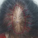 연세모에버의원 이미지