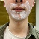 서울비전능현의원 | 아가파의원 미아점, 수염 레이저제모 2회차 후기 (젠틀맥스 프로플러스)