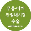 관절내시경 간단한 시술로 치료하는 무릎연골수술 – 반월상연골판파열의 절제술과 봉합술 이미지