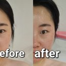 사하구피부관리:-) 물광피부 원해요? 라이콘 스파에센셜 뷰티랩 워터필 관리 후기
