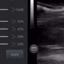 에스지테크널러지 이미지