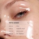 리티네일
