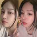 다이어트와 붓기 관리 필수 템! 닥터 하이 부기부기 하루 만에 효과 후기