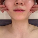 빛날윤에스테틱