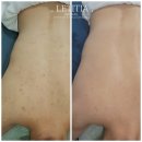 천안 RPC 이미지